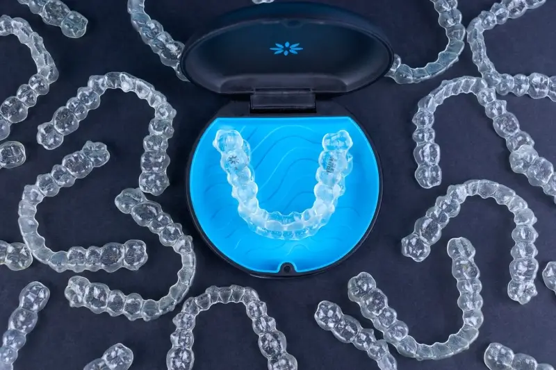Invisalign plan leczenia