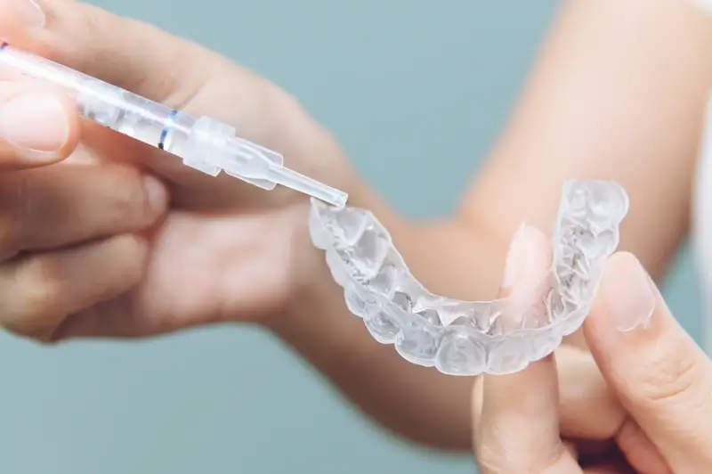 Prostowanie zębów metoda Invisalign