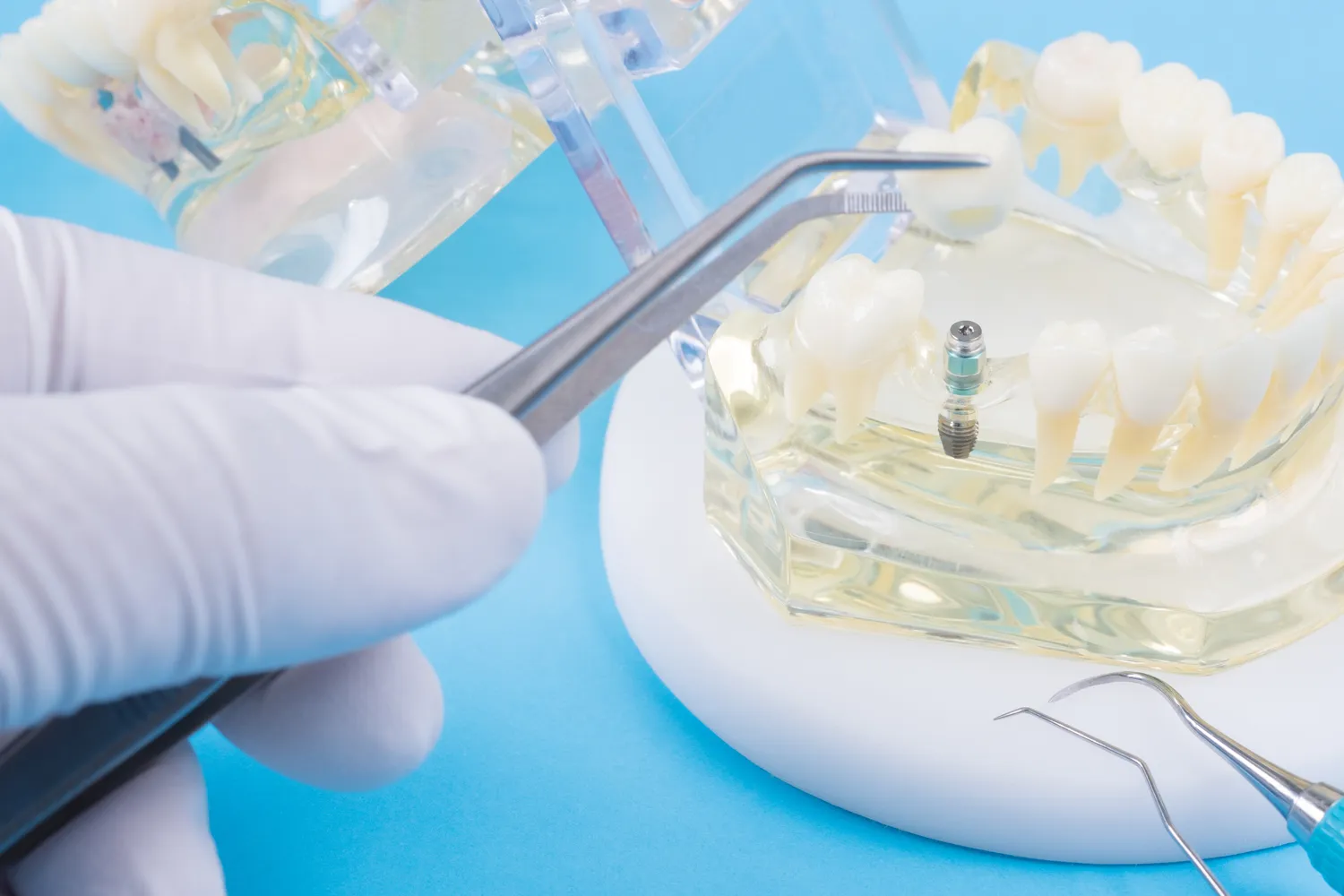 Stomatolog czy dentysta?