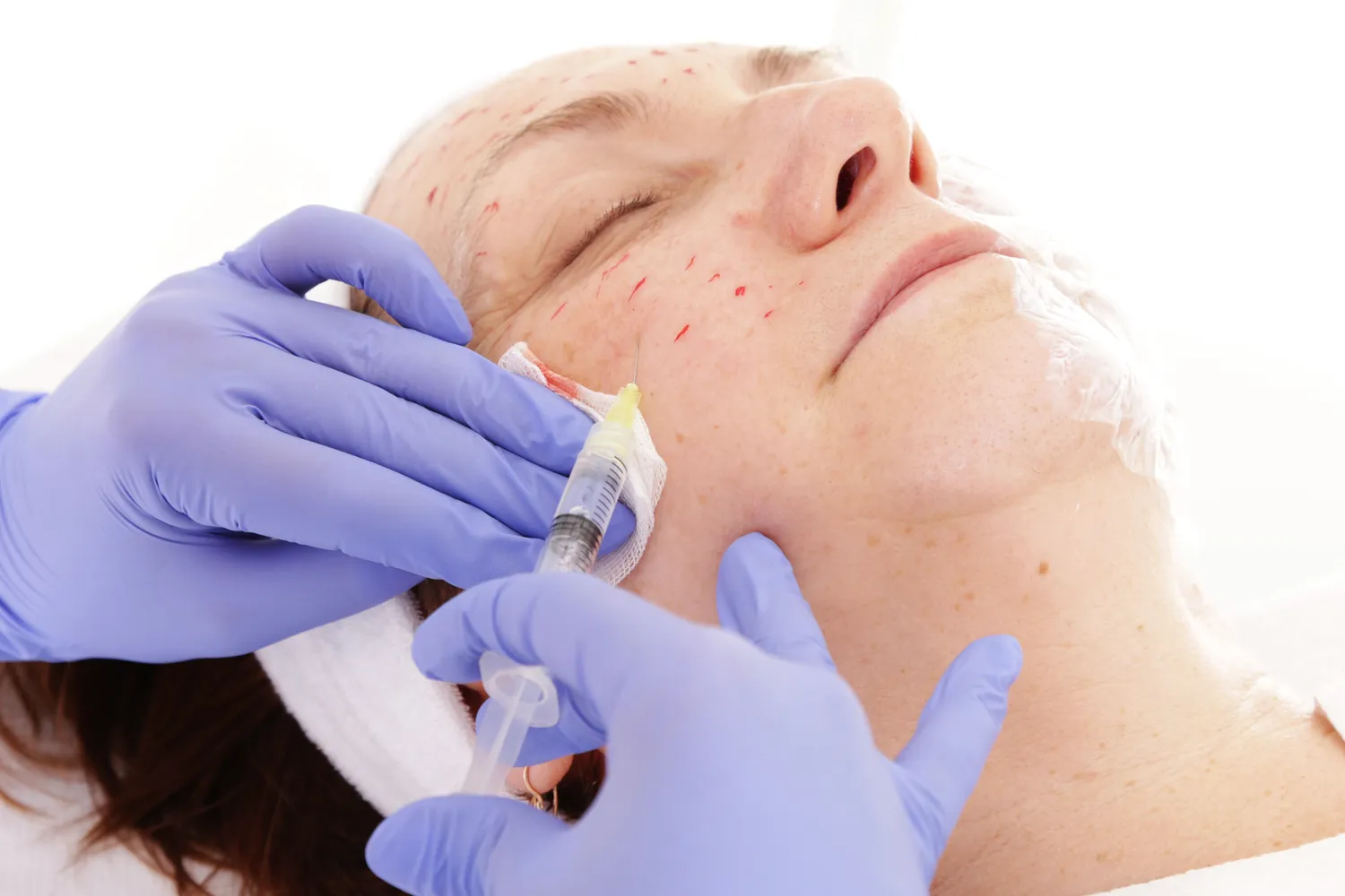 Co daje kwas hialuronowy w kolano?