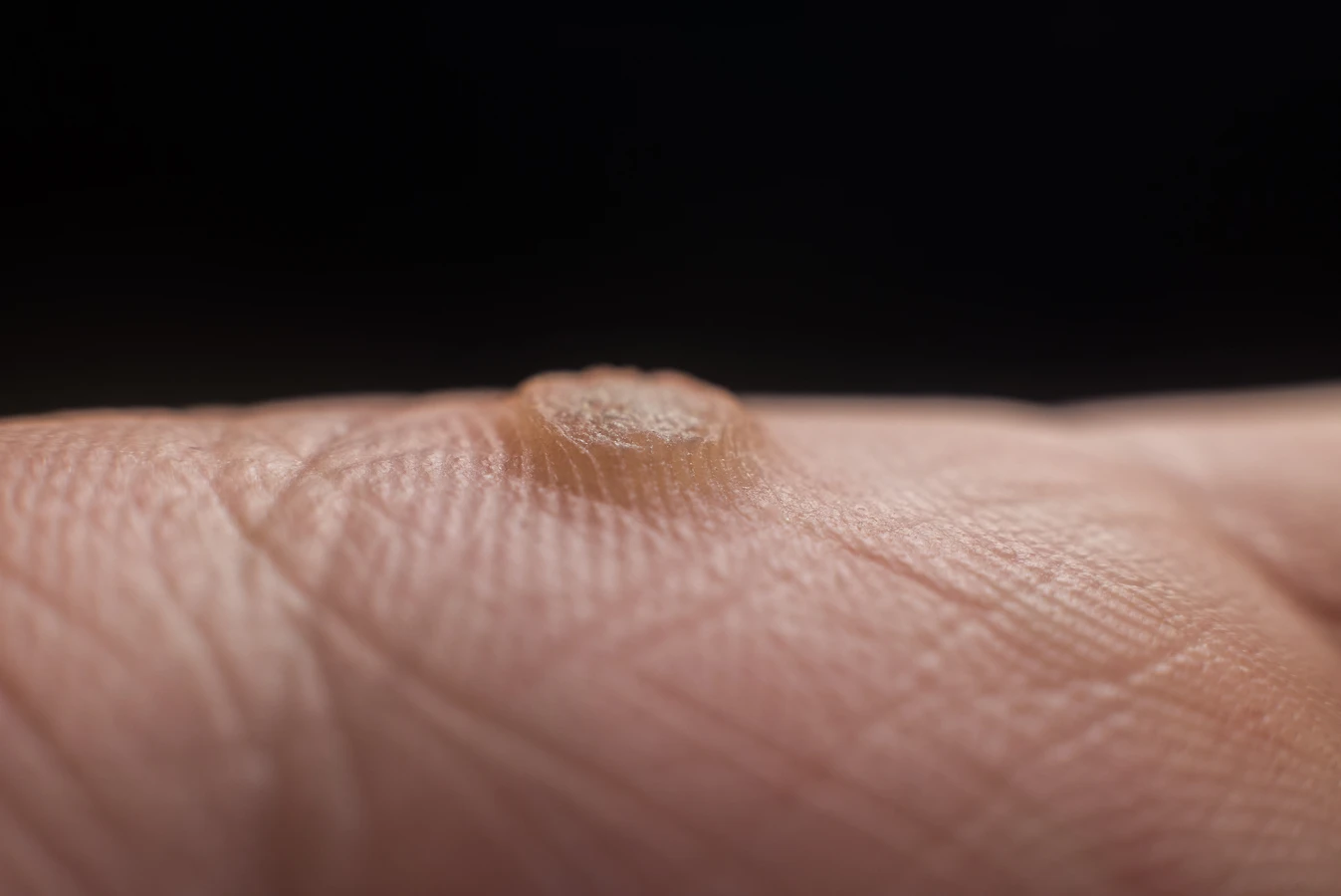 Jaka myjka ultradźwiękowa w gabinecie podologicznym?