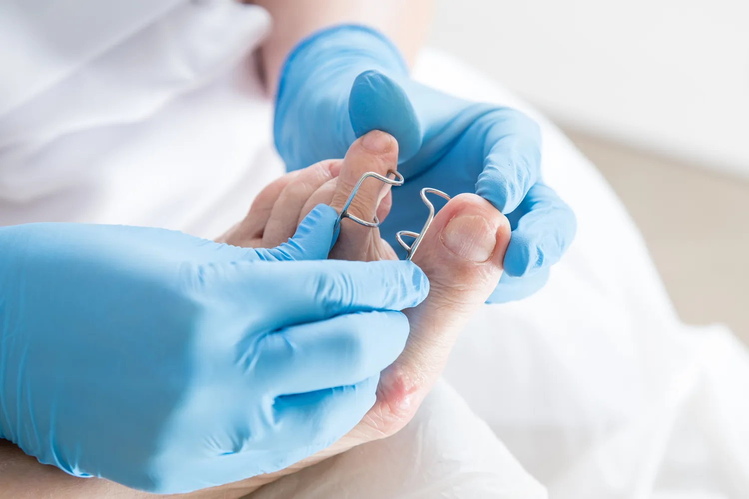  Kompleksowy przewodnik po podologii - co trzeba o niej wiedzieć?