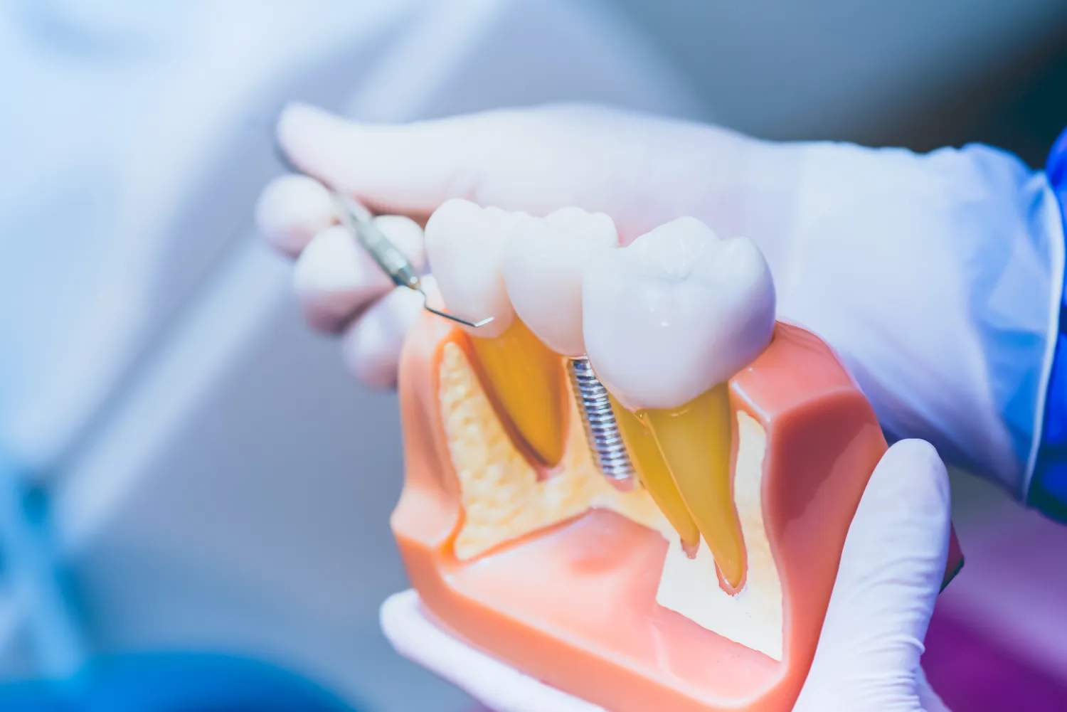 Endodoncja Szczecin