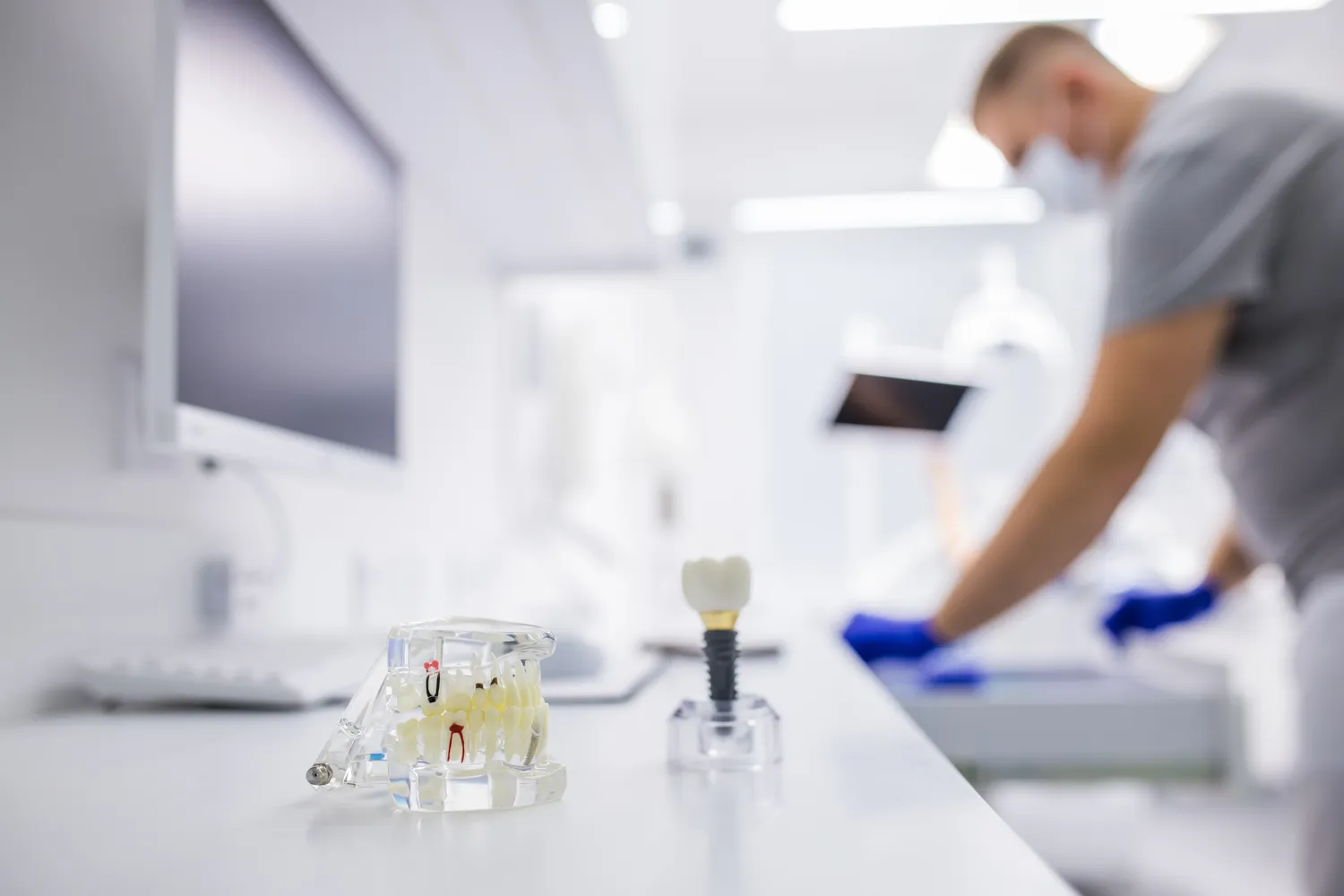 Implanty zębów cała szczęka Warszawa