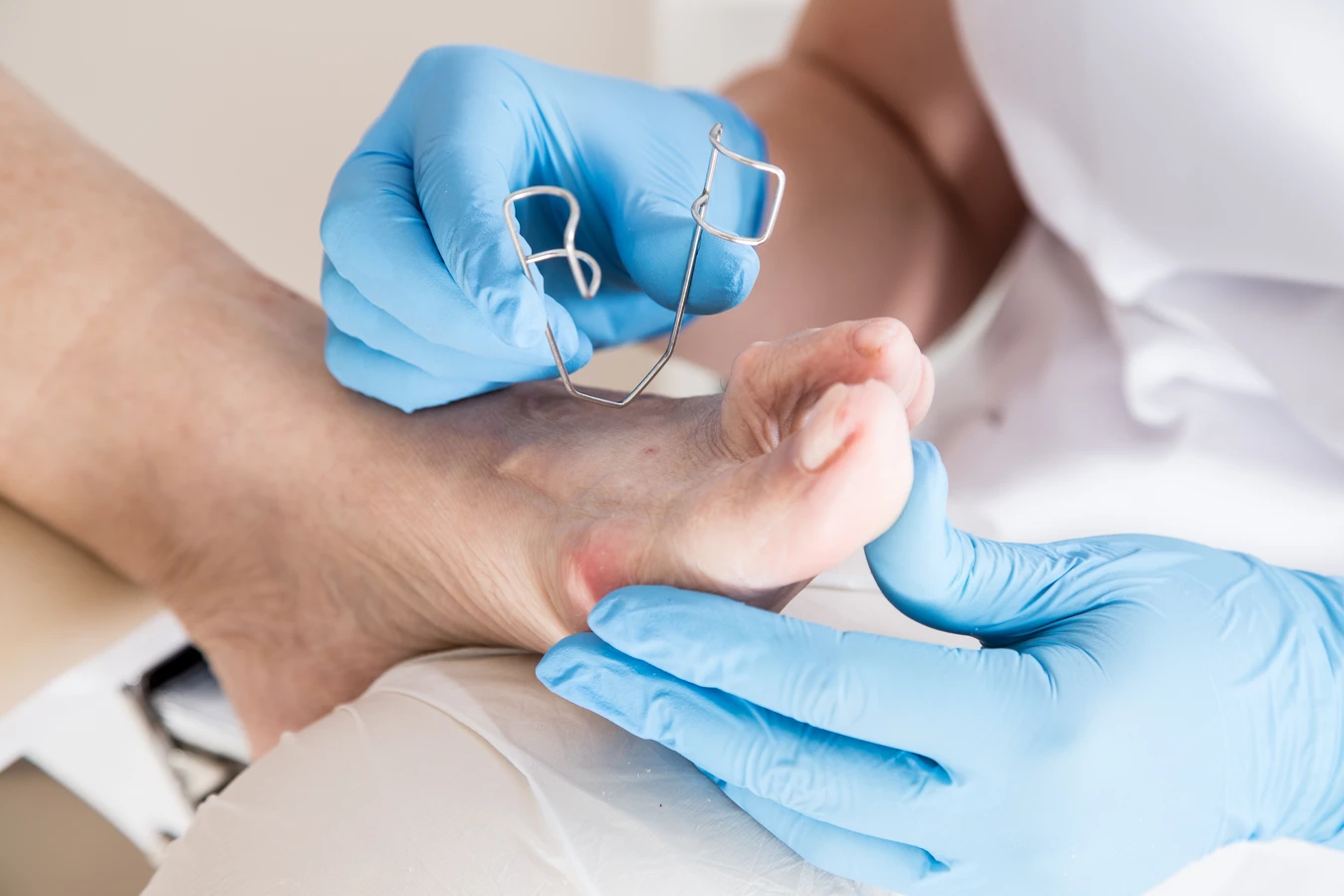 Czym jest podologia oraz czym dokładnie zajmuje się podolog?